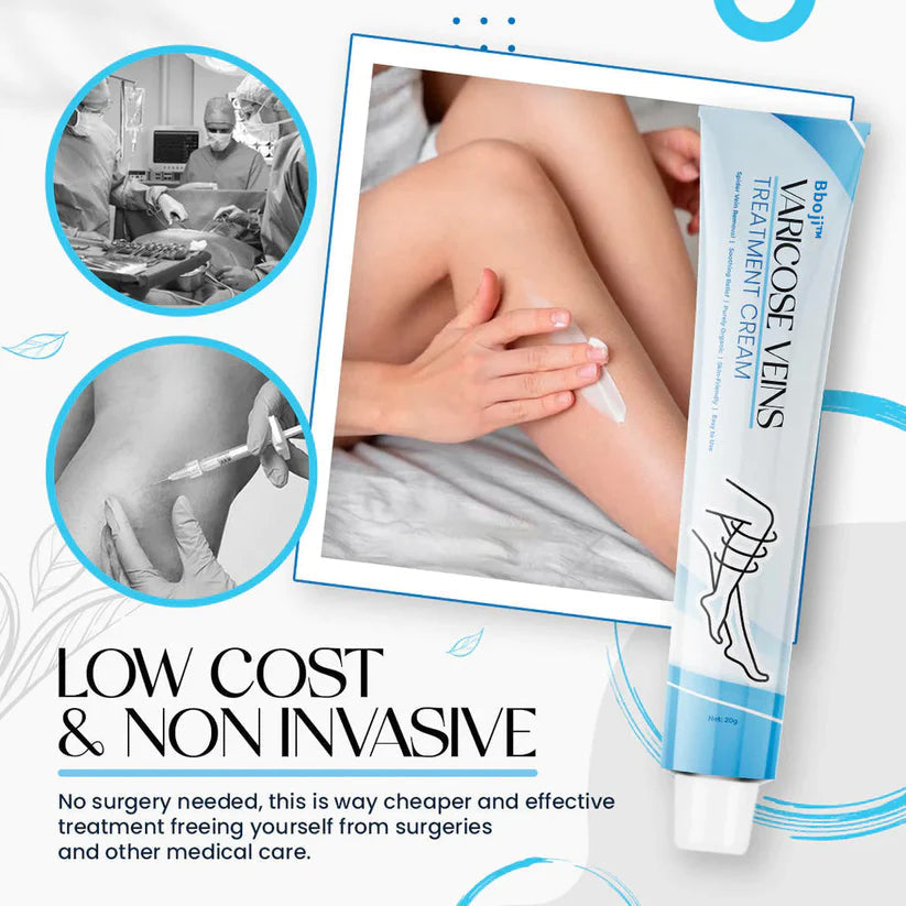 (🔥Last Day Promotion  - 50% off)Bboji™ Varicose Veins Treatment Cream